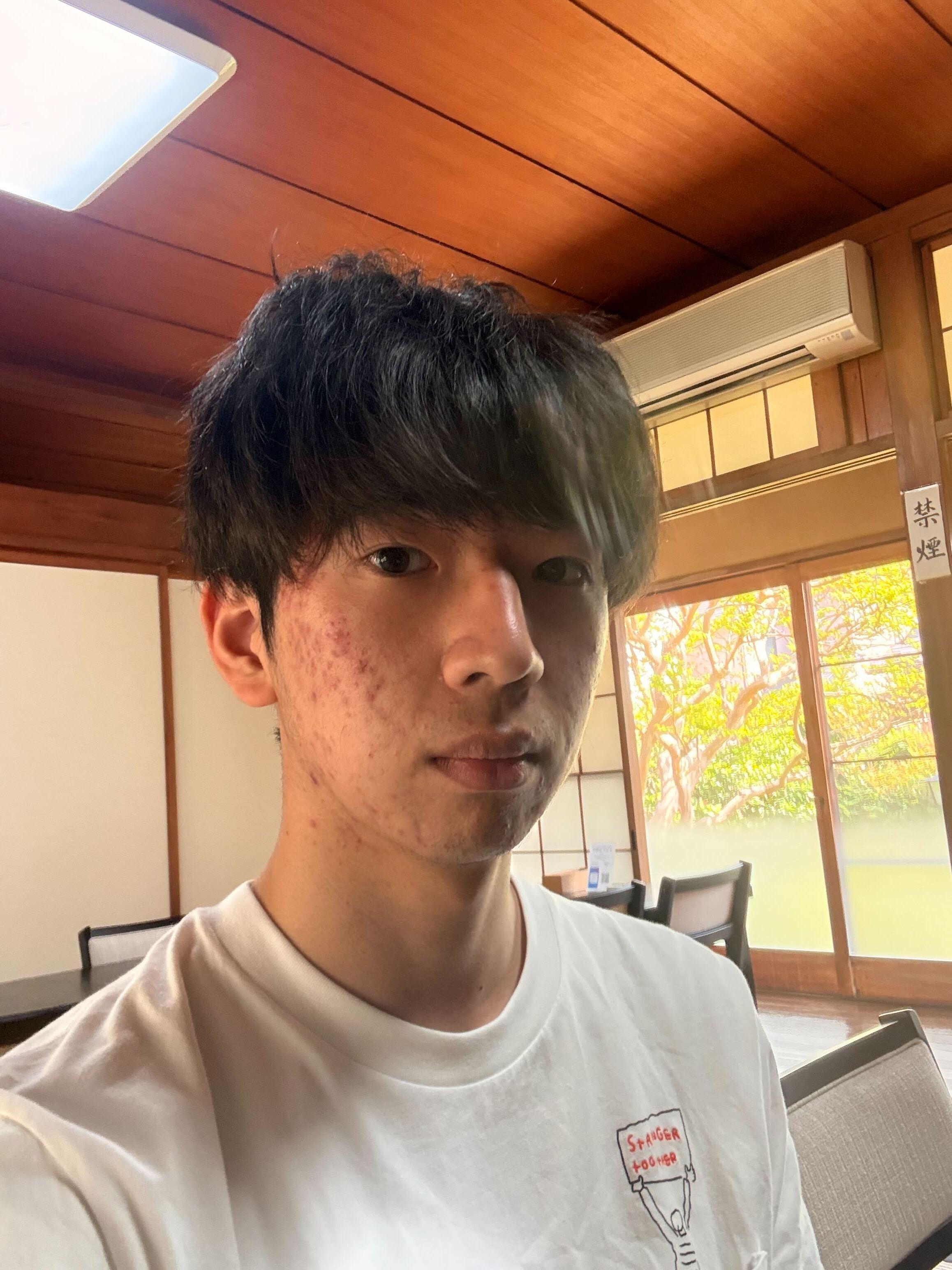 Shu Yamasaki